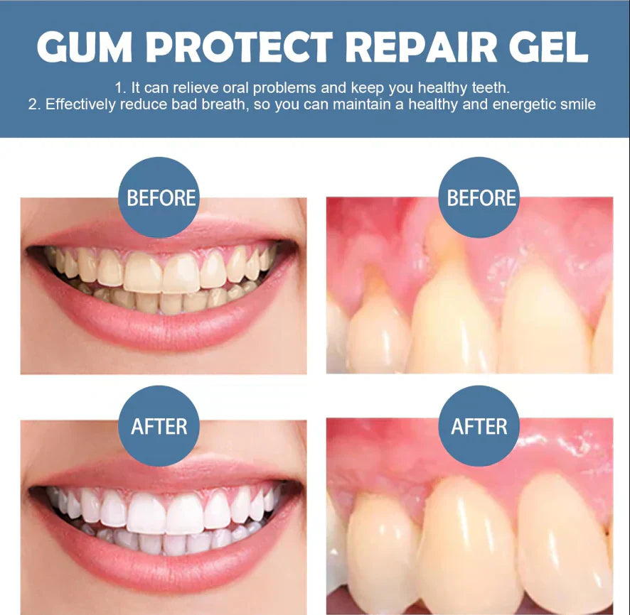 📢📢¡50% de descuento!⏰ Gel reparador y protector de encías 🦷