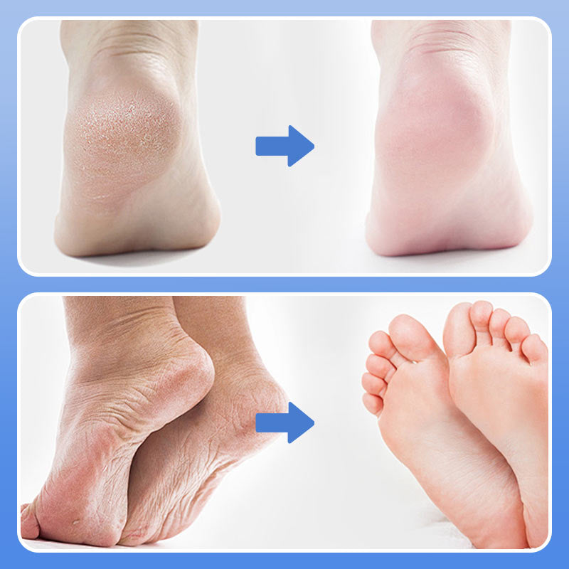 Crema hidratante facial y corporal antisequedad