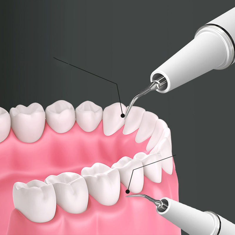 Limpiador dental ultrasónico portátil de alta eficiencia