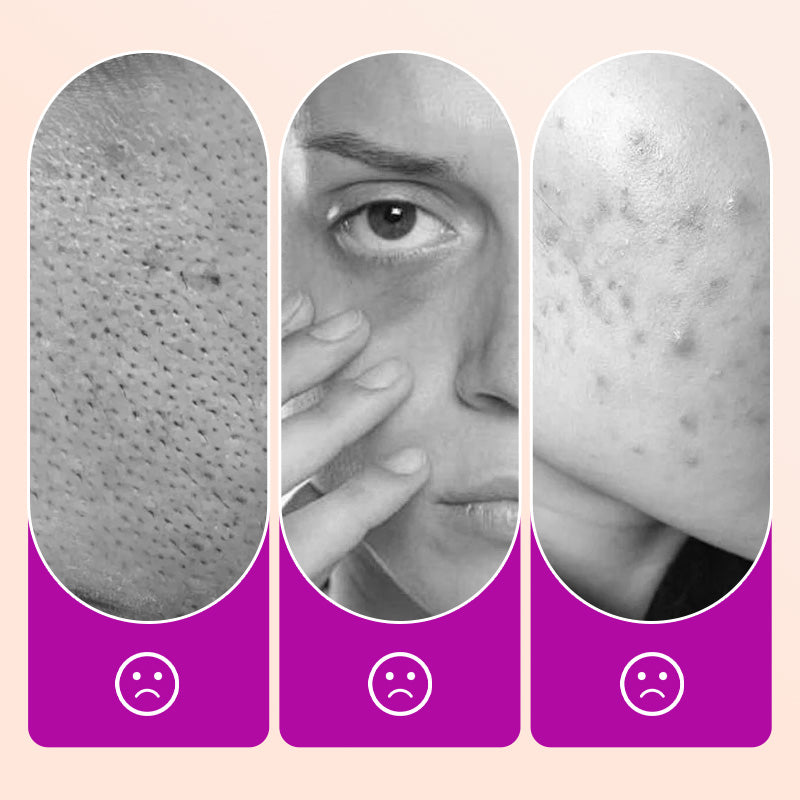 🔥 Corrector de ojeras Flawless｜Brighten Dark Circles, Crease - Free Finish
