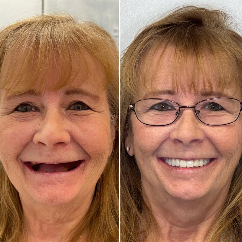 Crema adhesiva para dentaduras postizas de fijación fuerte durante todo el día