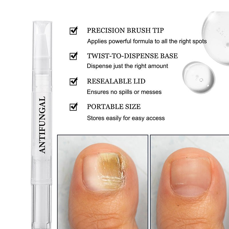 ✨Nuevas llegadas🔥Pluma para tratamiento de hongos en las uñas dañadas