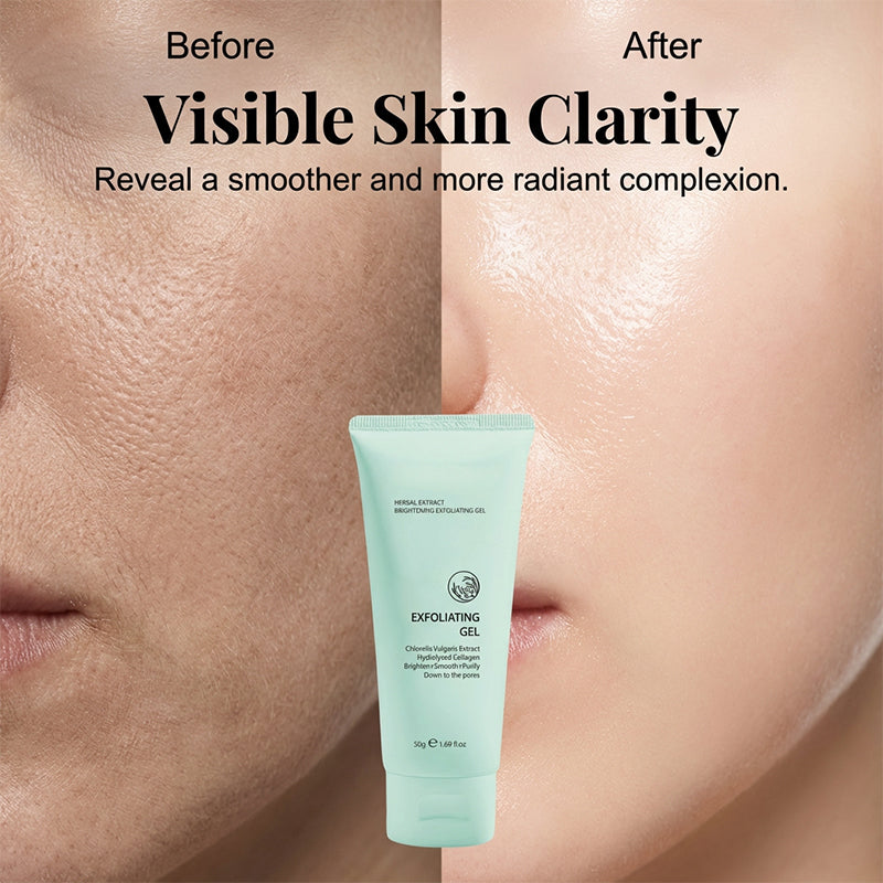 🥳OFERTA ESPECIAL 2026🥳💞¡MÁS DE 50 000 UNIDADES VENDIDAS!💥👵🌸 ¡50 % DE DESCUENTO! Gel exfoliante iluminador con extractos de hierbas